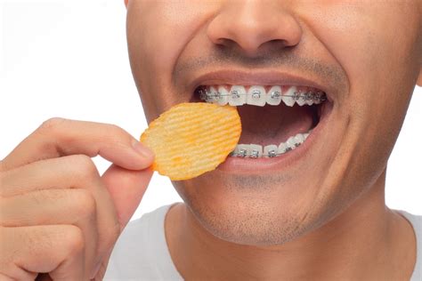 can you eat sun chips with braces